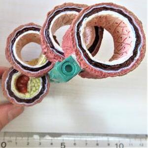 動脈硬化　血管断面模型